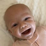 This is Emerson-3 months old. Diagnosed with TS at birth. We love our little butterfly!